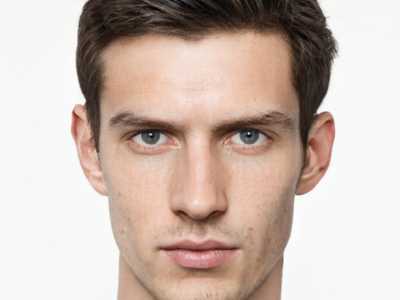 金州区氟斑牙的医生哪个做的好(张微医生名列前茅~)