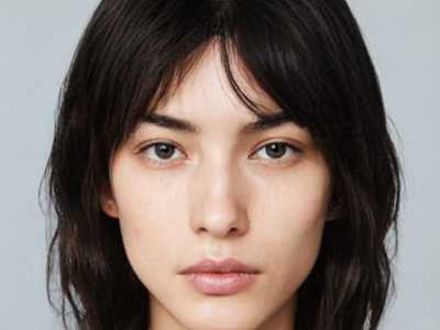 山大二院整形外科棒不棒｜孙强医生欧式双眼皮到底怎么样