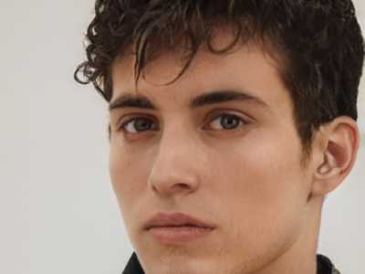 南宁人民解放军第303医院整形科怎么样｜王相斌医生高中女生割双眼皮给力不