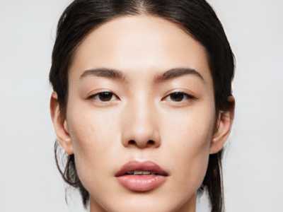 济南市纳米祛斑花多少钱-纳米祛斑价格在1731元起